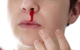 [ẢNH] Những loại bệnh dịch phổ biến do thời tiết ở Việt Nam